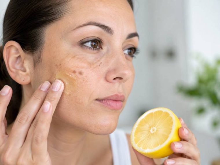 Citron et taches brunes sur le visage : quels effets et quelles précautions ?